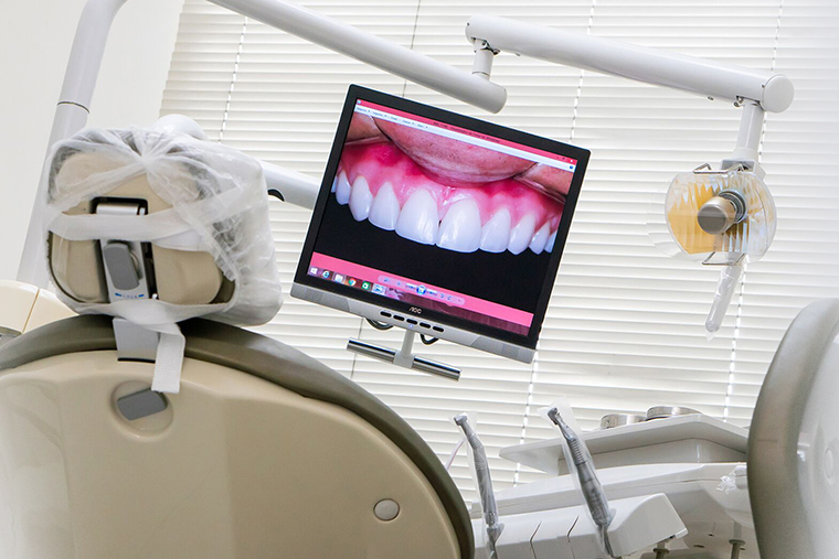 Clareamento dental: 7 vantagens de ir a uma clínica especializada