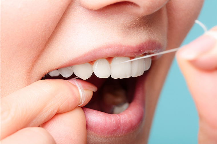Clareamento dental: 7 vantagens de ir a uma clínica especializada